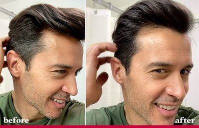 年紀(jì)輕輕就長(zhǎng)白頭發(fā)？從沐浴用品到生活方式的全方位應(yīng)對(duì)指南